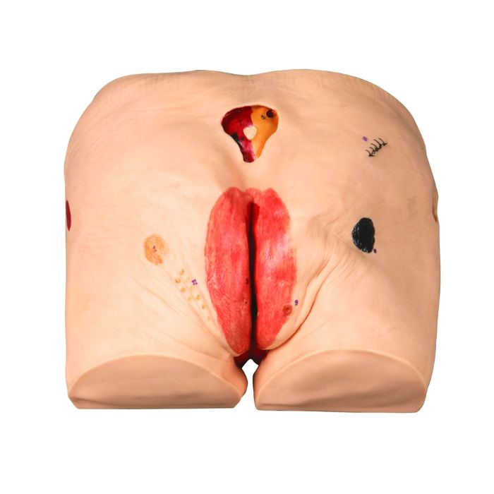 Decubitus Ulcer Care Simulator