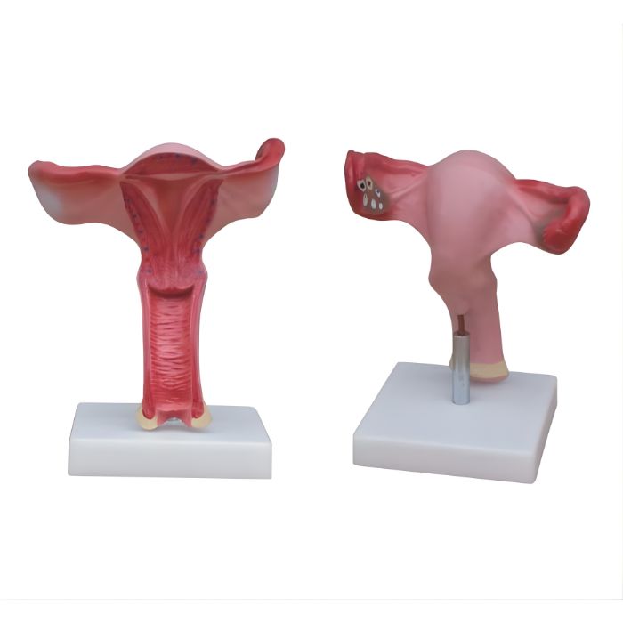 Magnified Uterus Model