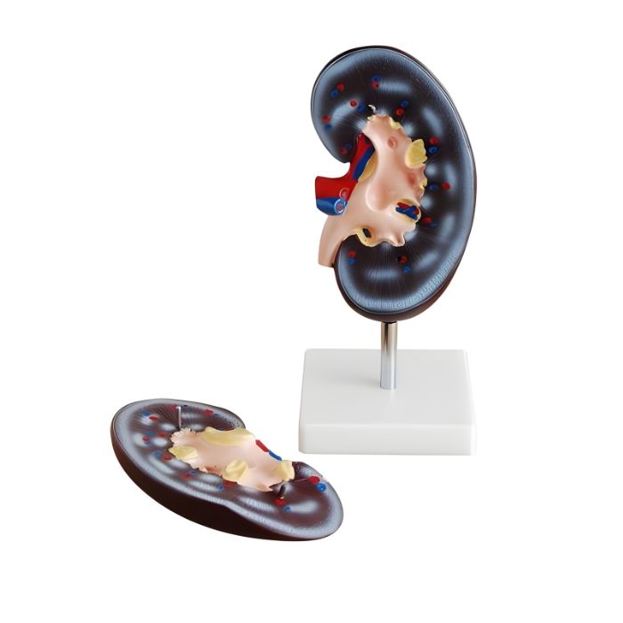 Kidney Model (2 parts)
