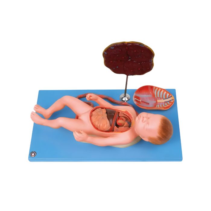 Fetus with Viscus and Placenta
