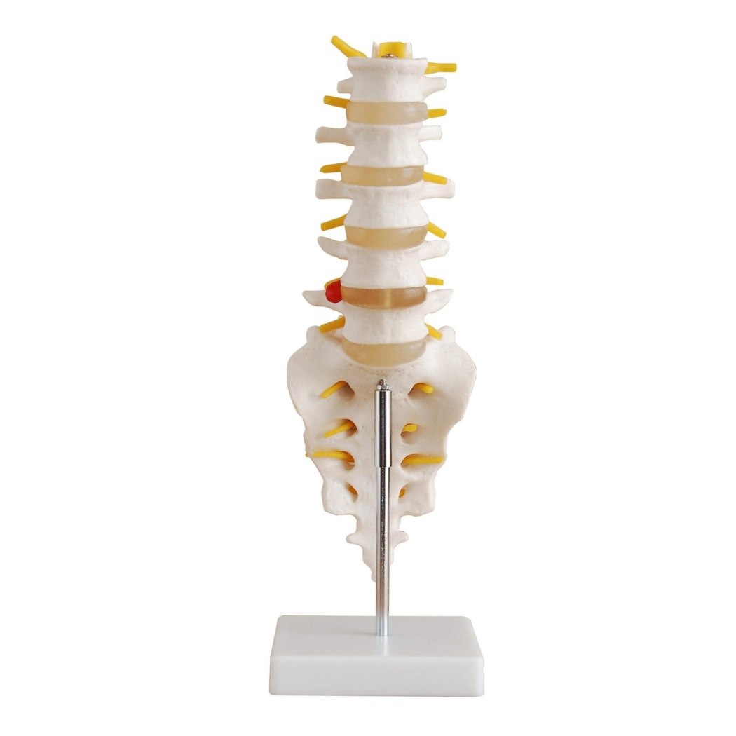 Life-Size Lumbar Vertebrae with Sacrum & Coccyx and Herniated Disc
