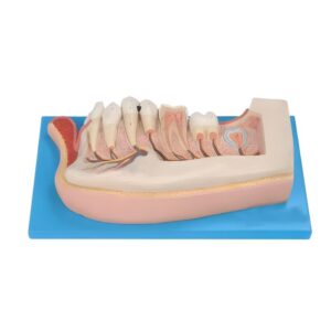 Lower Jaw of 12-year-old