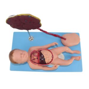 Fetus with Viscus and Placenta